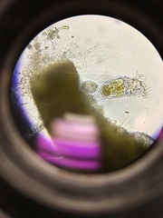 Philodina megalotrocha