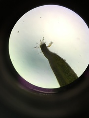 Philodina megalotrocha