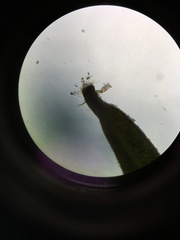 Philodina megalotrocha