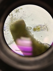 Philodina megalotrocha