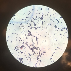 Bacillus cereus