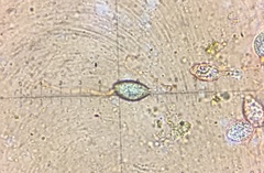 Podospora dakotensis