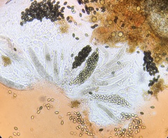 Podospora dakotensis