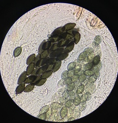 Podospora dakotensis