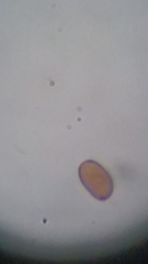 Psathyrella carinthiaca