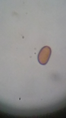 Psathyrella carinthiaca