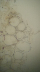 Psathyrella carinthiaca