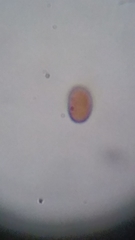 Psathyrella carinthiaca