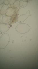 Psathyrella carinthiaca