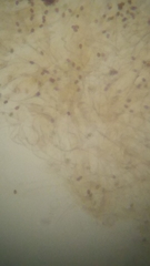 Psathyrella carinthiaca