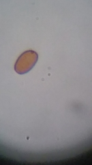 Psathyrella carinthiaca