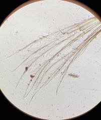 Pseudocypris spinosa