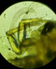 Pseudocypris spinosa