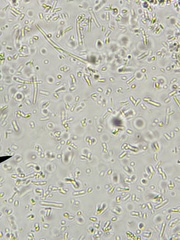 Bacillus