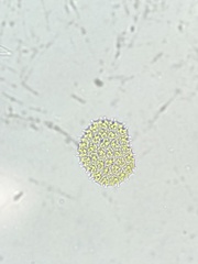 Hydrodictyaceae
