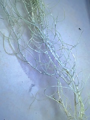 Usnea subgracilis