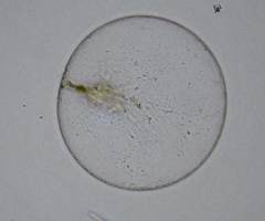 Noctiluca scintillans