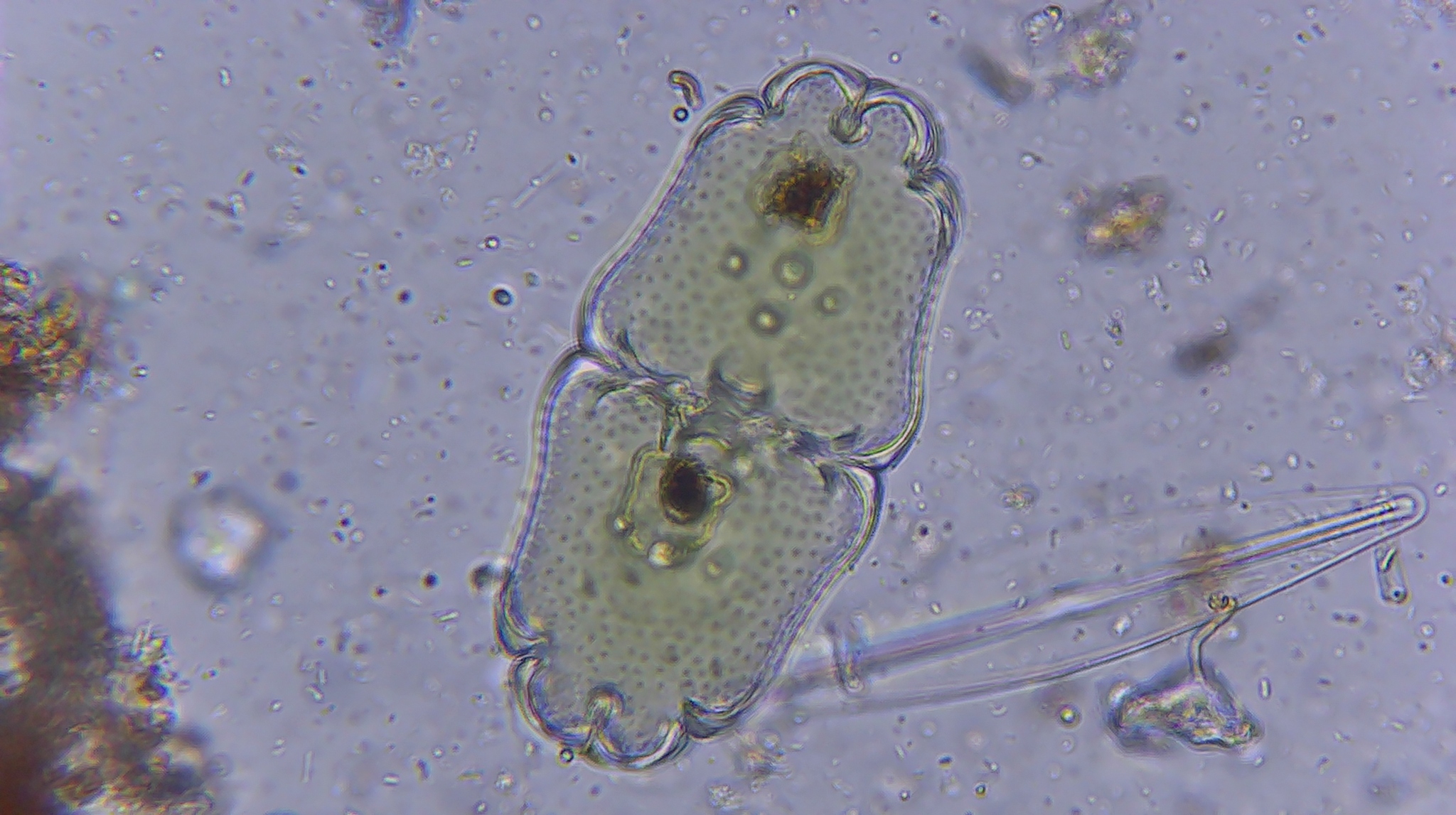 Euastrum crassum var. scrobiculatum