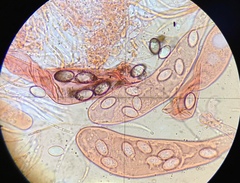 Saccobolus caesariatus