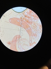 Saccobolus caesariatus