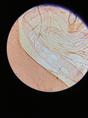 Saccobolus caesariatus