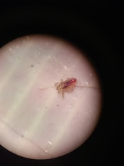 Pediculus humanus capitis