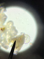 Gastrotricha