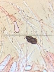 Saccobolus caesariatus