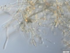 Botryobasidium conspersum