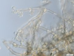 Botryobasidium conspersum