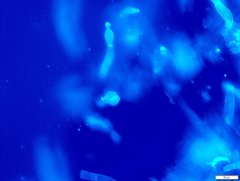 Botryobasidium conspersum