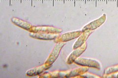 Clavariadelphus ligula