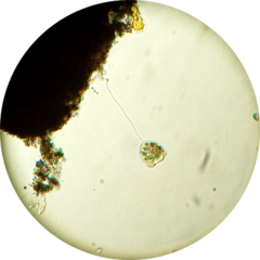 Vorticella campanula