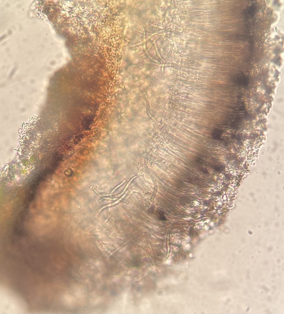 Bacidia helicospora