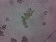 Cortinarius anomalus