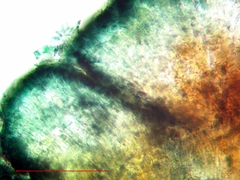 Lecidella carpathica