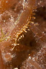 Virchowia
