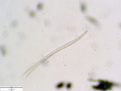 Pratylenchus penetrans