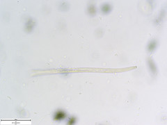 Pratylenchus penetrans