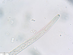 Pratylenchus penetrans