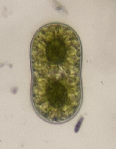 Actinotaenium diplosporum