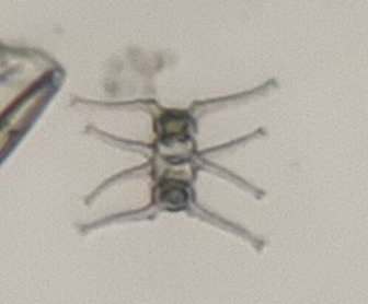 Staurastrum depressiceps