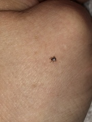 Amblyomma americanum