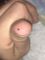 Amblyomma americanum