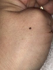 Amblyomma americanum