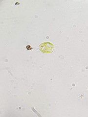 Phacus acuminatus