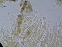 Melaspileella proximella