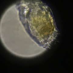 Philodina megalotrocha