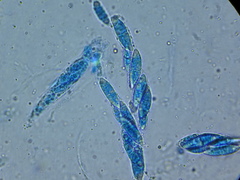 Nectriopsis heterodermiae