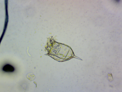 Keratella cochlearis